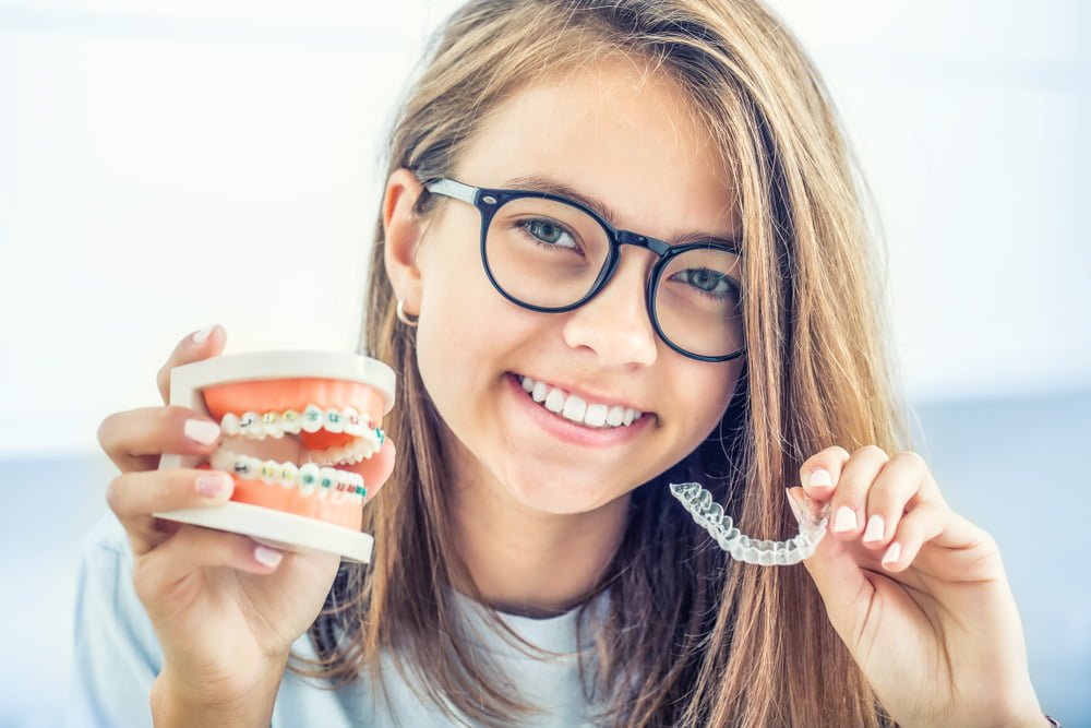 Book Ur Dentist Dental braces model