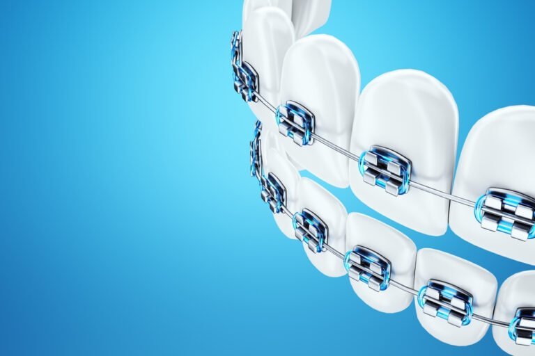 Book ur Dentist Braces