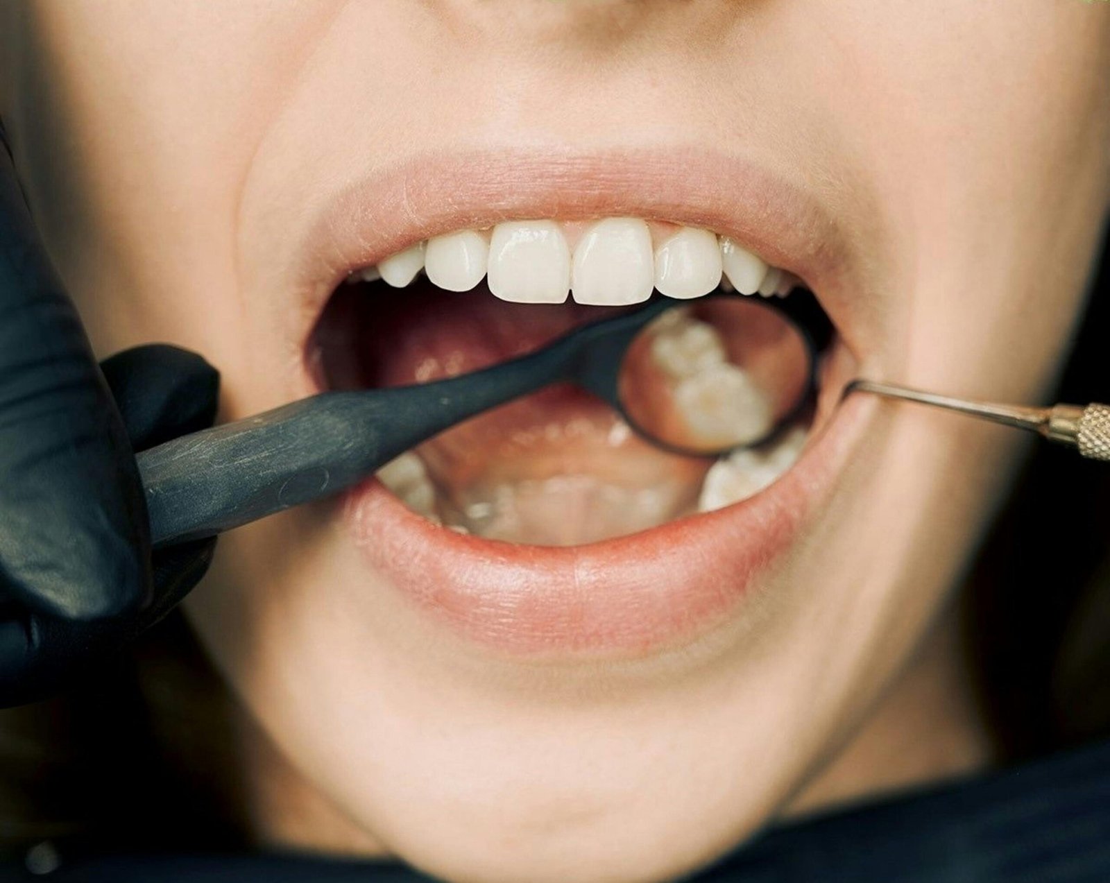 Close-up of dental examination with modern equipment, showcasing oral hygiene maintenance.
