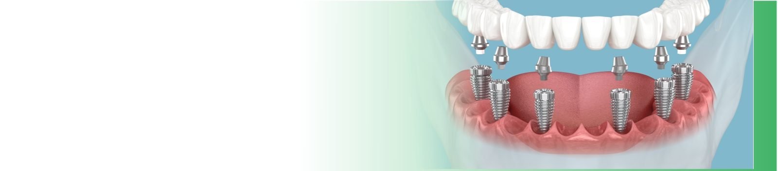 Book ur dentist Dental_ Slider 1600 x 353 _ 01 Book ur dentist Dental_ Slider 1600 x 353 _ 01